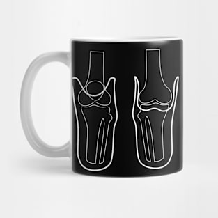 Transtibial X-Ray Mug